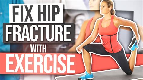 Exercise After Hip Fracture