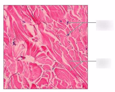 dense irregular connective tissue Diagram | Quizlet