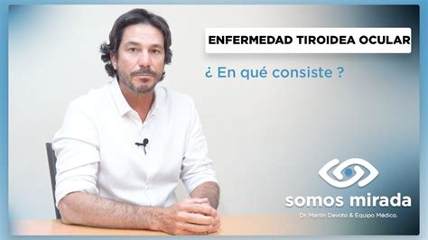 Qu Es La Enfermedad Tiroidea Ocular Como Tratarla Youtube