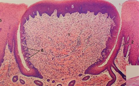 Circumvallate Papillae Diagram Quizlet