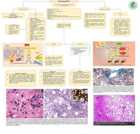 Esteatosis Hepática Patología Medical student Kath ESGA uDocz