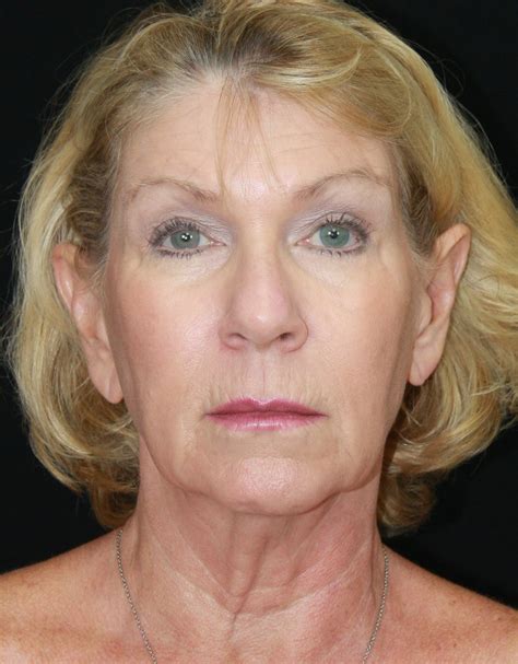 Palm Beach Facial Plastic Surgery