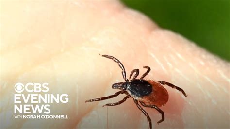 Growing Number Of Meat Allergy Cases Linked To Tick Bites Cdc Warns