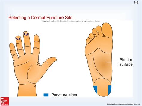 Dermalcapillary Puncture Ppt Download