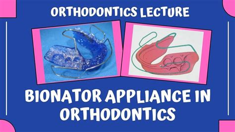 Bionator Appliance In Orthodontics Dr Manase Youtube