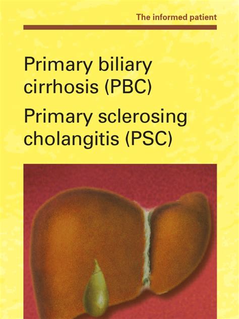 Primary Biliary Cirrhosis Primary Sclerosing Cholangitis Cirrhosis