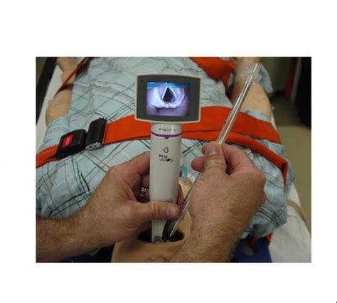 Rigid Curved Ambu Kingvision Portable Video Laryngoscope, Size Of Blade ...