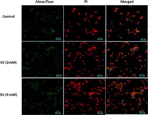 Immunofluorescence Analysis Of E Cadherin Expression In Control And