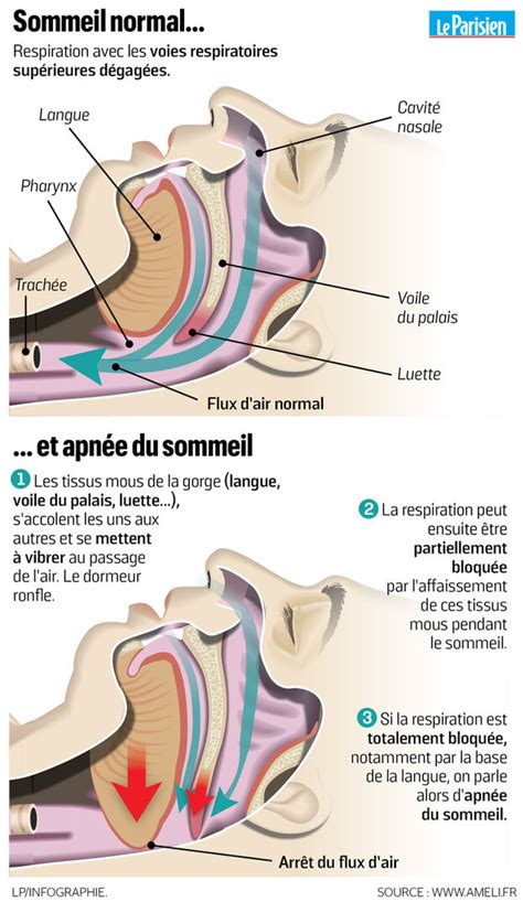 Lapnée du sommeil cest grave Démêlez le vrai du faux Le Parisien