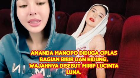 Amanda Manopo Diduga Oplas Bagian Bibir Dan Hidung Wajahnya Disebut