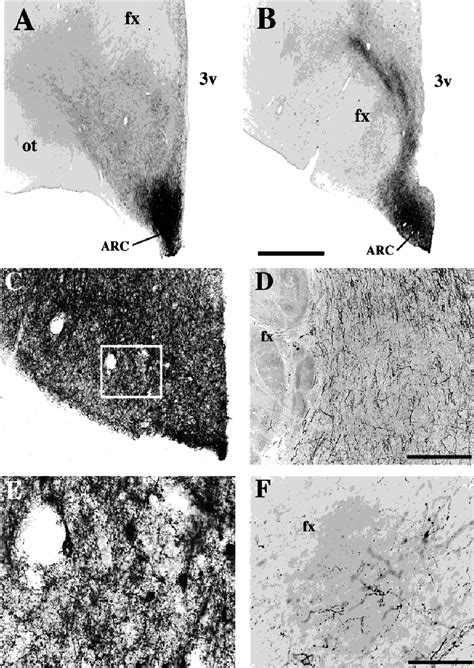 Series Of Photomicrographs Demonstrating That Agrp Ir Neurons Are