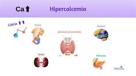 Guía Completa Sobre La Hipercalcemia Causas Síntomas Y Tratamiento 2024