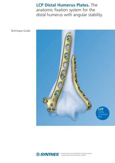 LCP Distal Humerus Plates The Anatomic Fixation Osteosyntese