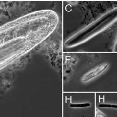 Phase contrast micrograph showing a portion of a large, morphotype A... | Download Scientific ...