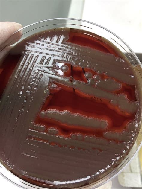 Bacillus Cereus Mannitol Salt Agar