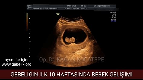 Ve Haftalik Gebel Kte A Iklamali Ultrason G R Nt Ler Yle