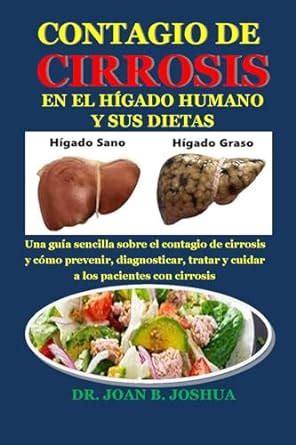 CONTAGIO DE CIRROSIS EN EL HÍGADO HUMANO Y SUS DIETAS Una guía