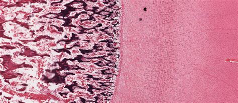 Endochondral Bone Formation Histology