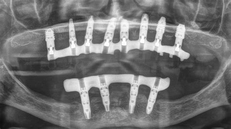 Casos Clínicos Dentales Plus Odontología Magazine