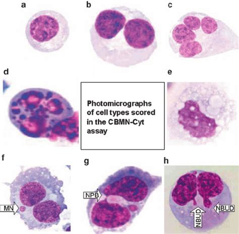 Photomicrographs Of The Cells Scored In The CBMN Cytome Assay A