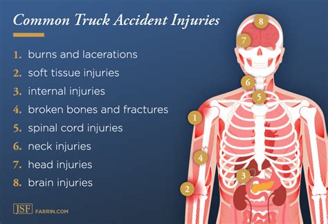 Truck Accident Injuries Types Symptoms And Treatment NBKomputer