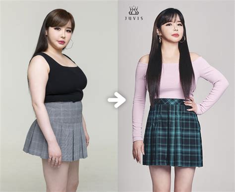 박봄 쥬비스 다이어트 후 “11kg 줄고 감정기복도 완화” 세계일보