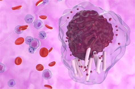 C Lula De Leucemia Linfoc Tica Cr Nica Llc En El Flujo Sangu Neo