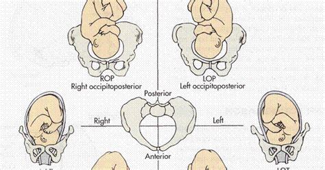 Optimal Fetal Positions