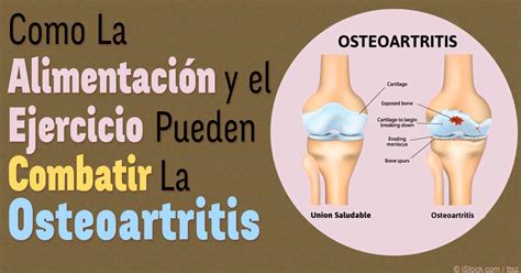 Ejercicios Para La Osteoartritis De Cadera