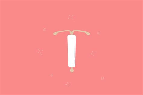 Vector Illustration Of Iud Contraception 2204096 Vector Art At Vecteezy