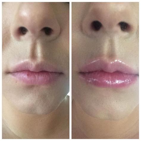 List Pictures Too Faced Lip Injection Extreme Before And After