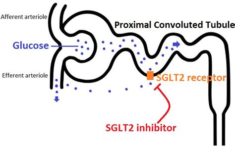 Euglycemic Diabetic Ketoacidosis Associated With Use Of Sglt2 Inhibitor