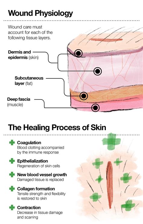 How to Suture a Wound: Laceration Repair and Recovery – The Amino Company