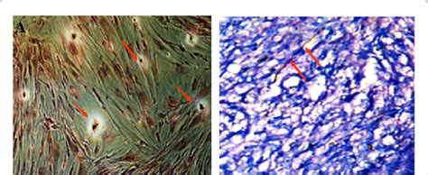 Multilineage Differentiation Potential Of Human Adipose Derived Stem