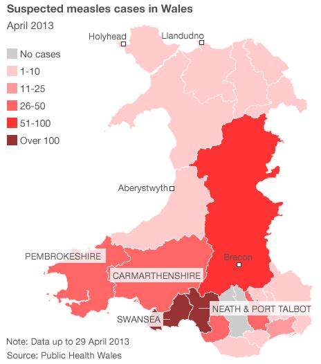 Swansea Measles Epidemic Tops Cases Bbc News