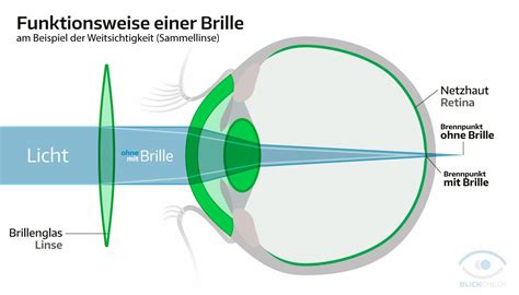 Luxus Kurz Und Weitsichtigkeit