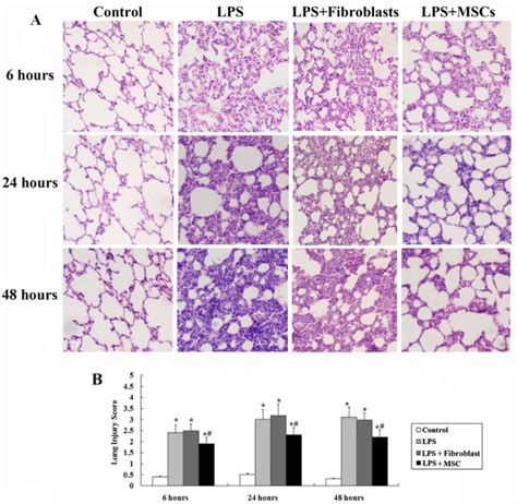 A Histological Analysis Indicated Lps Injection Caused Capillary