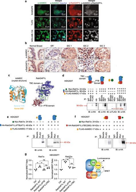 Aamdc Interacts With The Gtpase Activating Protein Rabgap1l A