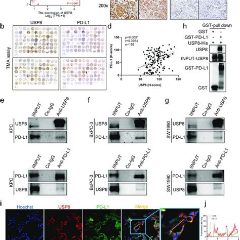 In Pancreatic Cancer Usp Interacts Positively With Pd L A