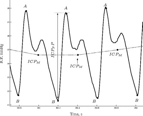 Figure 1 From Significance Of Intracranial Pressure Pulse Morphology In