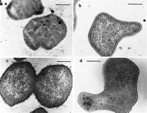 Thermococcus Litoralis Archaebacteria 