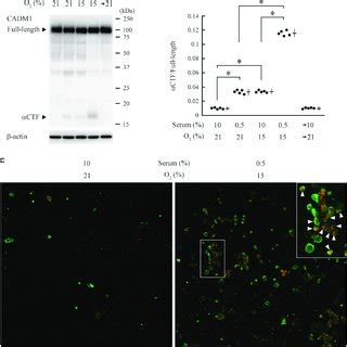 Induction Of Urinary Cell Adhesion Molecule Cadm Ectodomain