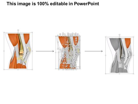 0514 Knee Lateral View Medical Images For Powerpoint Powerpoint