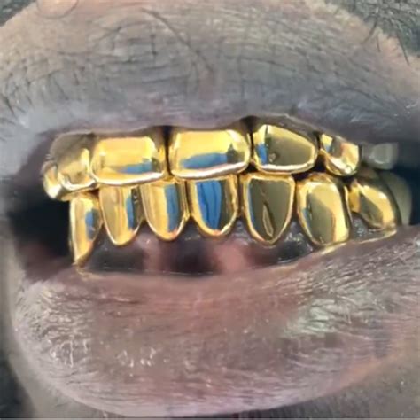 22k Gold Grillz Gold Teeth Master
