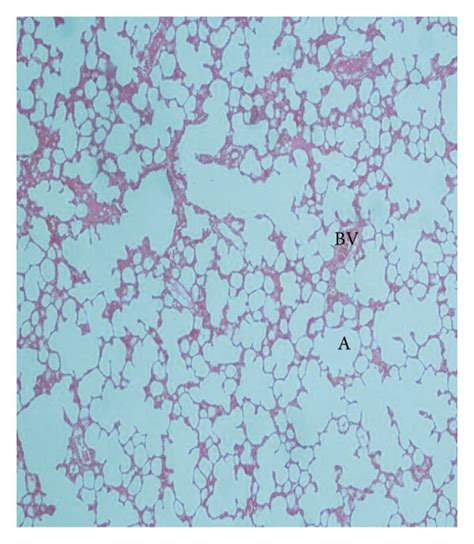 Representative Micrographs Of The Lung Tissue In Spraguedawley Rats Download Scientific