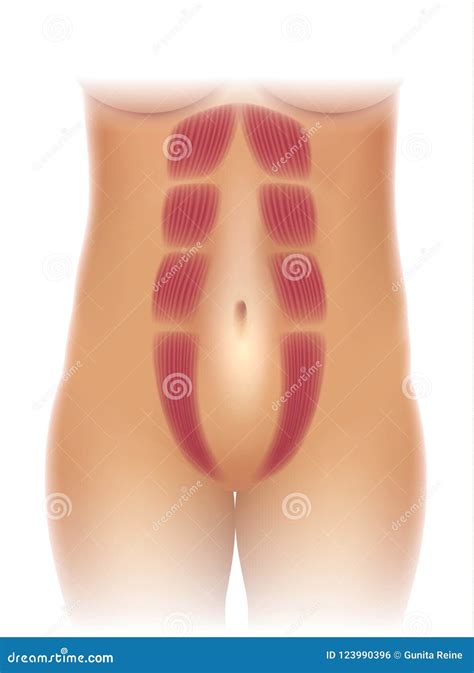 Diastasis Recti D Medical Illustration On White Background Royalty