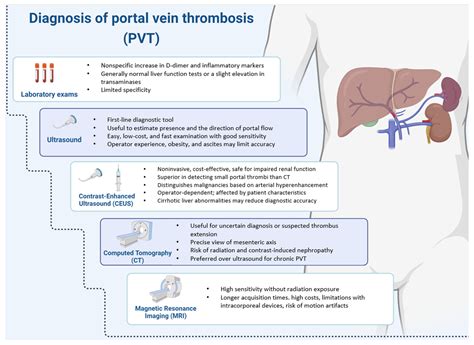 Jcm Free Full Text Portal Vein Thrombosis State Of The Art Review