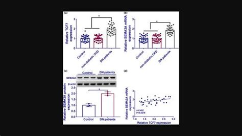 LncRNA TCF7 Contributes To High Glucose Induced Damage In Human