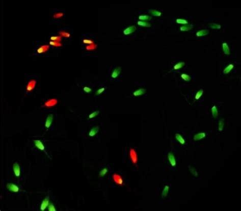 Stallion Sperm Stained With Acridine Orange Ao Sperm With Normal