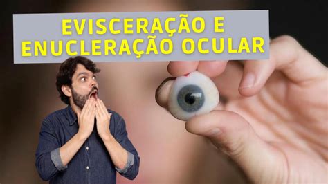 Evisceração e Enucleração ocular Dr João Paulo Lomelino YouTube